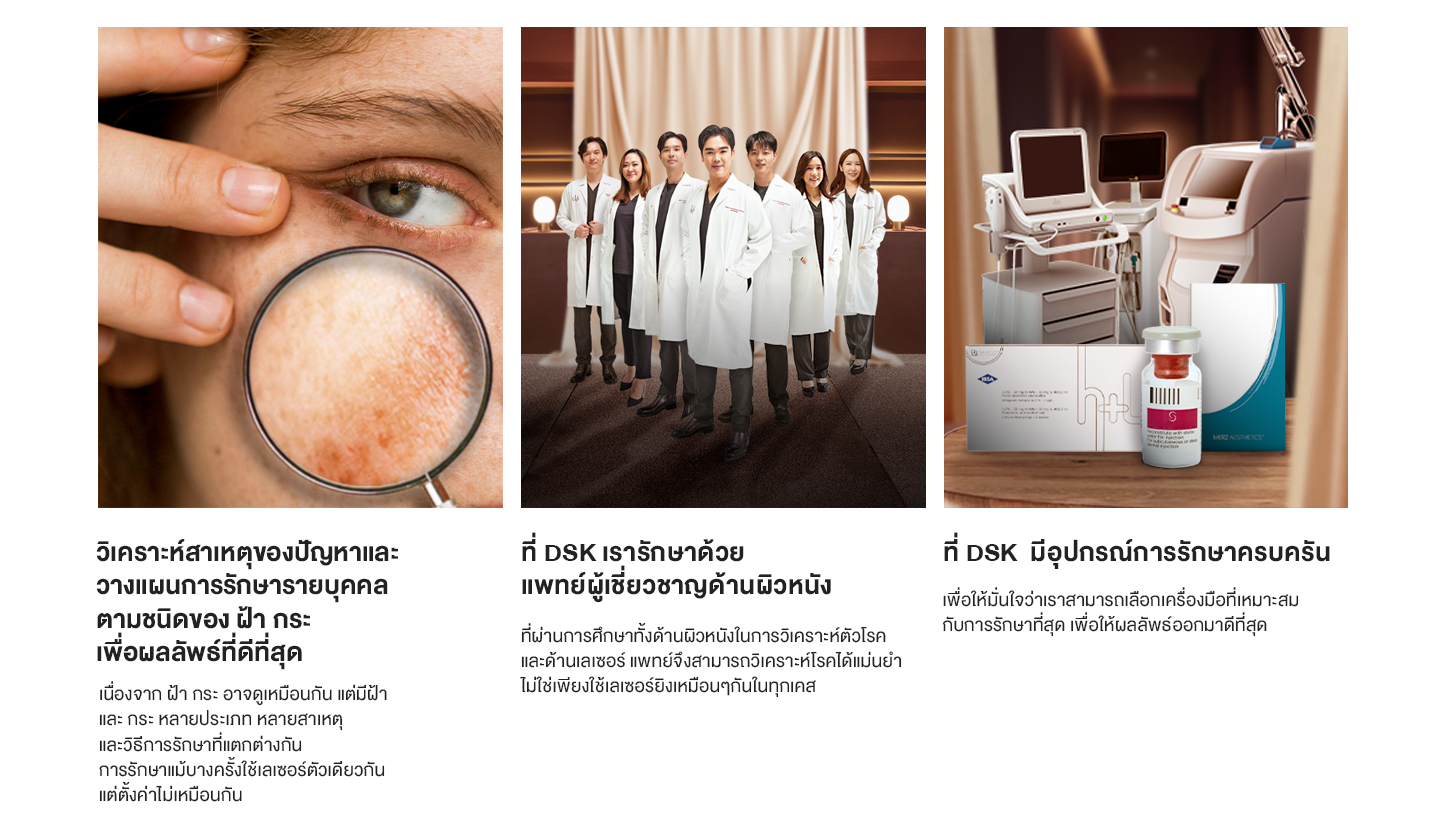 ทำไมต้อง melasma