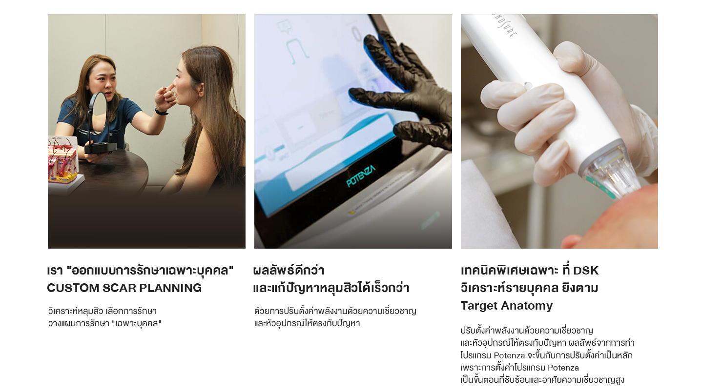 ทำไมต้อง potenza