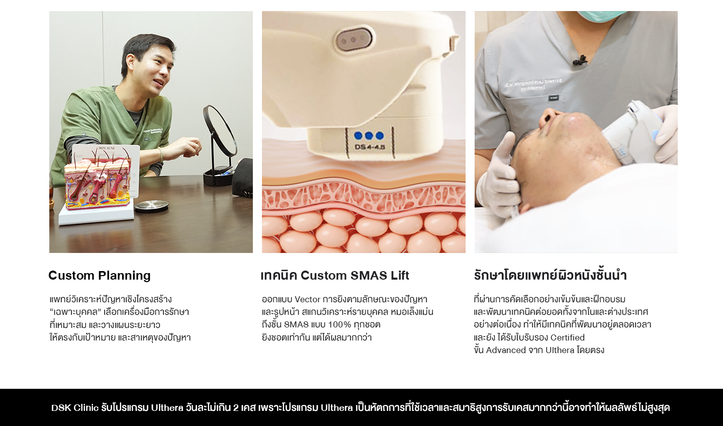 ทำไมต้อง ulthera (1)