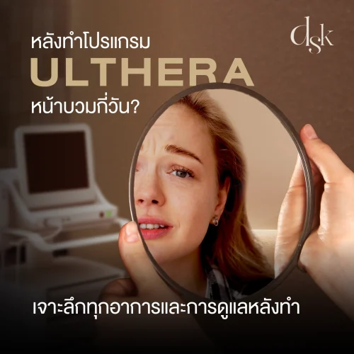 หลังทำโปรแกรม Ulthera หน้าบวมกี่วัน? เจาะลึกทุกอาการและการดูแลหลังทำ