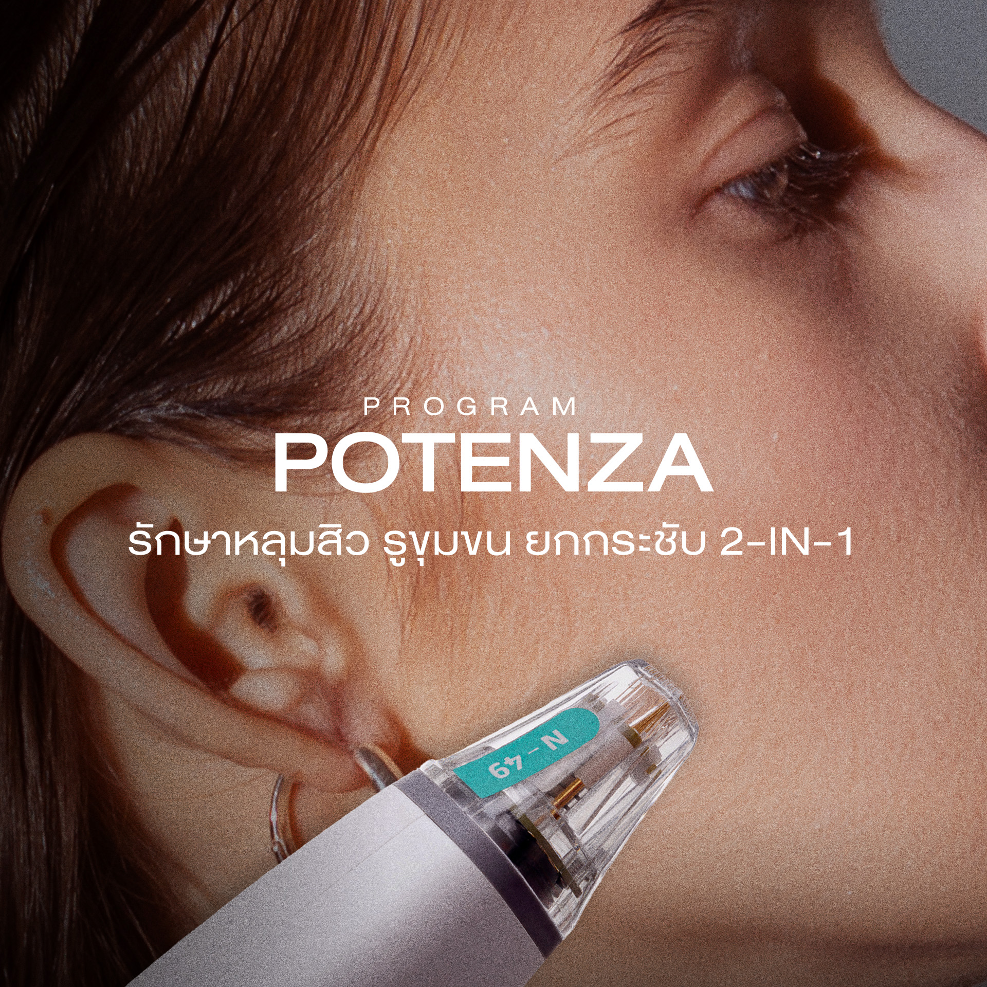 รักษาหลุมสิว พร้อมกระชับผิว