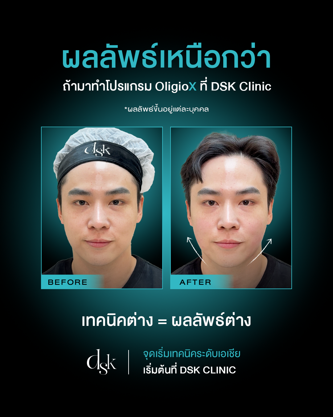 รีวิว OligioX