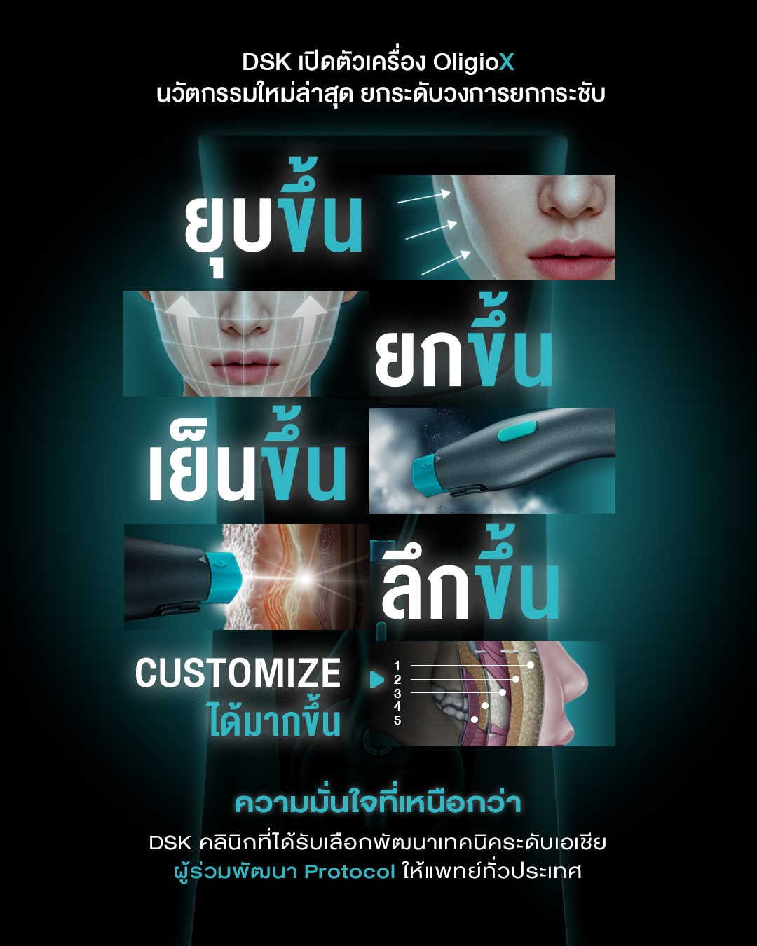 OligioX ที่ DSK Clinic